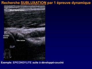 Recherche SUBLUXATION par 1 épreuve dynamique
           SUPINATION




 Condyle
 latéral
               Tête radiale




Exemple: EPICONDYLITE suite à développé-couché
 