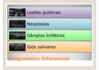 Adi Ecografia De Massas Cervicais PDF adi-ecografia-de-massas-cervicais-pdf