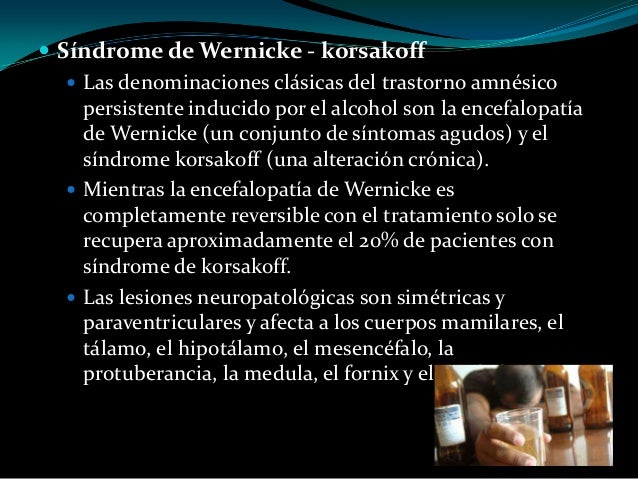 La codificación del alcohol el precio en rostove