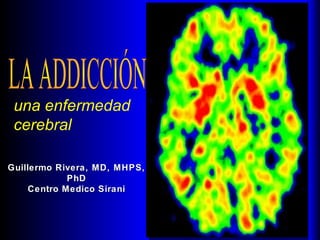 una enfermedad
cerebral
Guillermo Rivera, MD, MHPS,Guillermo Rivera, MD, MHPS,
PhDPhD
Centro Medico SiraniCentro Medico Sirani
 