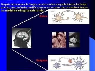 Después del consumo de drogas, nuestro cerebro no queda intacto. La droga
produce una profundas modificaciones en el cerebro, que en muchos casos, se
mantendrán a lo largo de toda la vida.
 