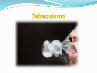 Tabaquismo
 
