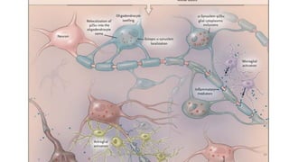 Autonomic Dysfunction Multi System Autonomic Dysfunction in Multiple System Atrophy and Parkinson's ...