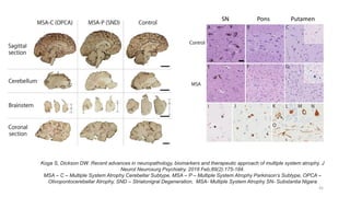 Autonomic Dysfunction in Multiple System Atrophy and Parkinson's ...