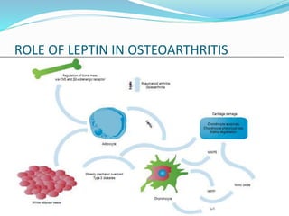 ROLE OF LEPTIN IN OSTEOARTHRITIS
 