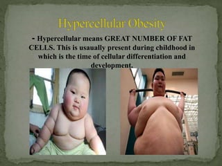 - Hypercellular means GREAT NUMBER OF FAT 
CELLS. This is usaually present during childhood in 
which is the time of cellular differentiation and 
development. 
 