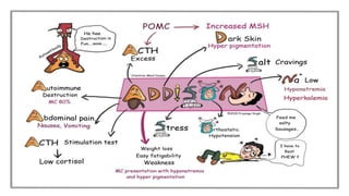 Addison DISEASE.pptx