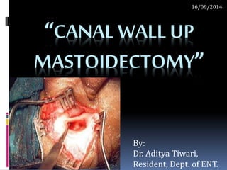“CANAL WALL UP
MASTOIDECTOMY”
By:
Dr. Aditya Tiwari,
Resident, Dept. of ENT.
16/09/2014
 
