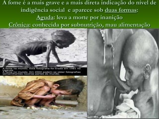 Nos países subdesenvolvidos ou do Sul a situação é bem diferente Setor primário numeroso