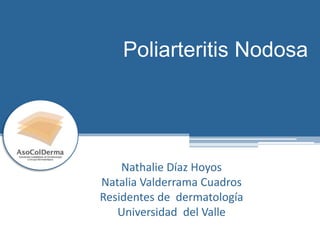 Poliarteritis Nodosa
Nathalie Díaz Hoyos
Natalia Valderrama Cuadros
Residentes de dermatología
Universidad del Valle
 