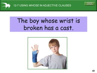 42
12-7 USING WHOSE IN ADJECTIVE CLAUSES
The boy whose wrist is
broken has a cast.
 