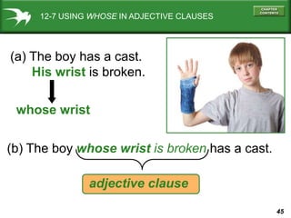 45
12-7 USING WHOSE IN ADJECTIVE CLAUSES
(a) The boy has a cast.
His wrist is broken.
(b) The boy whose wrist is broken has a cast.
adjective clause
whose wrist
 