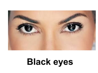 Black eyes
 