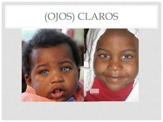 (OJOS) CLAROS
 