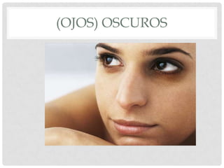 (OJOS) OSCUROS
 