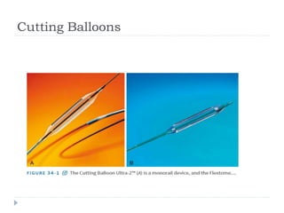 Cutting Balloons
 