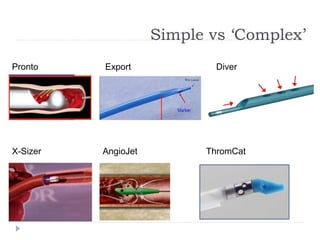 Simple vs ‘Complex’
X-Sizer AngioJet ThromCat
Pronto Export Diver
 