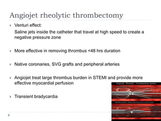 Angiojet rheolytic thrombectomy
 Venturi effect:
Saline jets inside the catheter that travel at high speed to create a
negative pressure zone
 More effective in removing thrombus <48 hrs duration
 Native coronaries, SVG grafts and peripheral arteries
 Angiojet treat large thrombus burden in STEMI and provide more
effective myocardial perfusion
 Transient bradycardia
 
