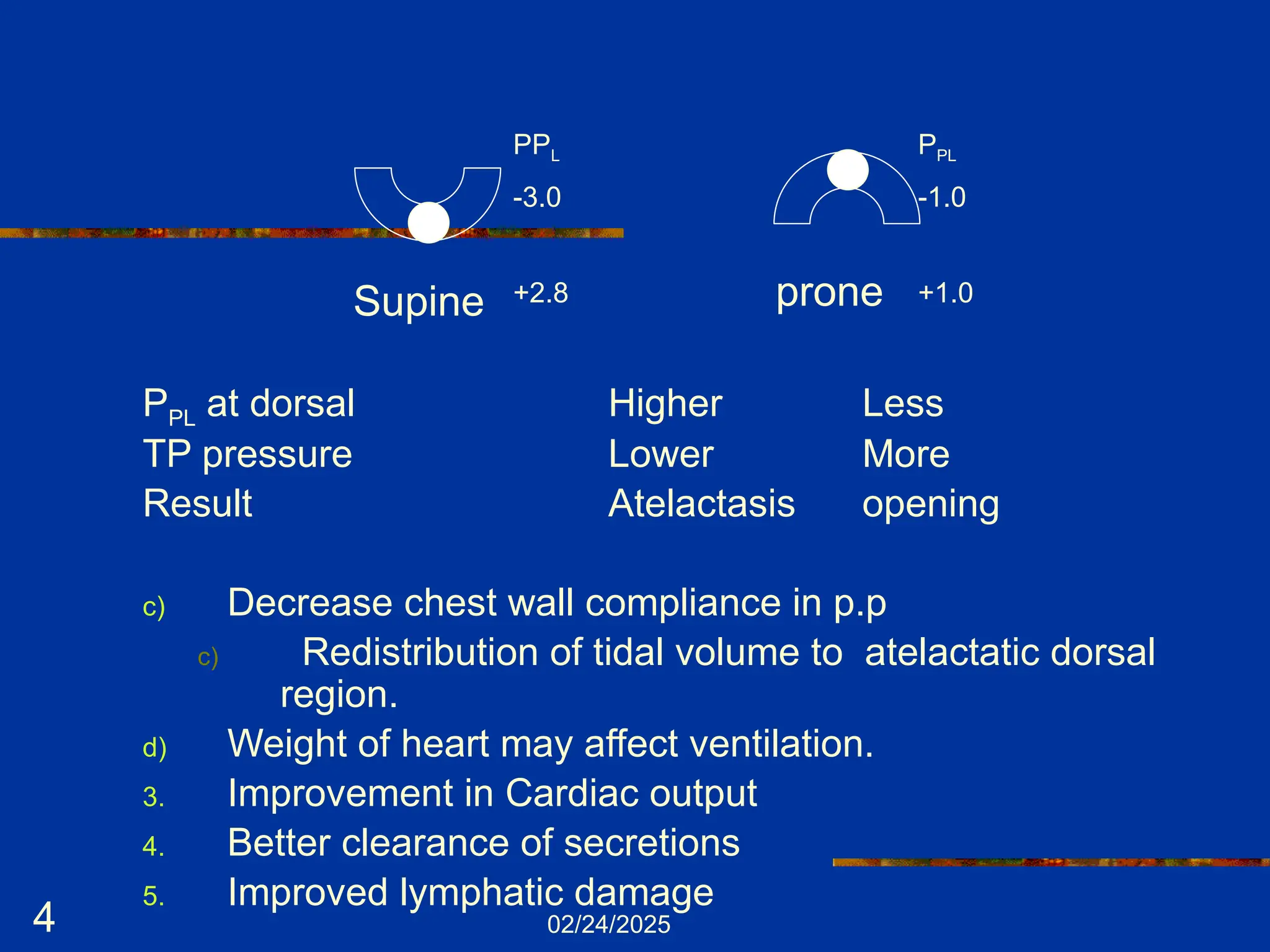 02/24/2025
4
PPL
-3.0
+2.8
PPL
-1.0
+1.0
Supine prone
PPL at dorsal Higher Less
TP pressure Lower More
Result Atelactasis opening
c) Decrease chest wall compliance in p.p
c) Redistribution of tidal volume to atelactatic dorsal
region.
d) Weight of heart may affect ventilation.
3. Improvement in Cardiac output
4. Better clearance of secretions
5. Improved lymphatic damage
 
