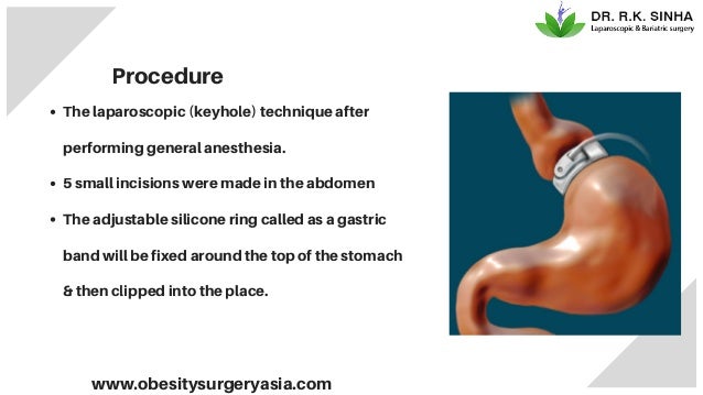 Garcinia tablets reviews picture 3