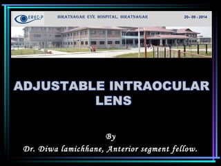 M
BIRATNAGAR EYE HOSPITAL, BIRATNAGAR 20– 09 - 2014
By
Dr. Diwa lamichhane, Anterior segment fellow.
 