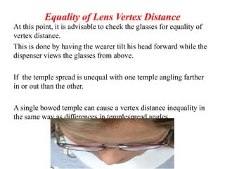 Equality of Lens Vertex Distance
At this point, it is advisable to check the glasses for equality of
vertex distance.
This is done by having the wearer tilt his head forward while the
dispenser views the glasses from above.
If the temple spread is unequal with one temple angling farther
in or out than the other.
A single bowed temple can cause a vertex distance inequality in
the same way as differences in templespread angles.
 