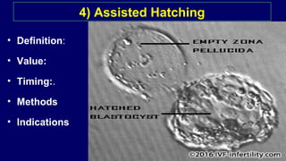 • Definition:
• Value:
• Timing:.
• Methods
• Indications
4) Assisted Hatching
 