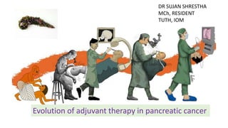 Evolution of adjuvant therapy in pancreatic cancer
DR SUJAN SHRESTHA
MCh, RESIDENT
TUTH, IOM
 