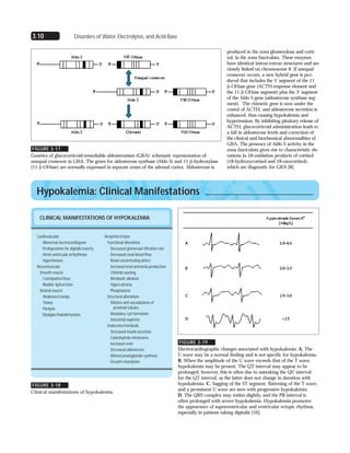 3.10 Disorders of Water, Electrolytes, and Acid-Base
FIGURE 3-17
Genetics of glucocorticoid-remediable aldosteronism (GRA): schematic representation of
unequal crossover in GRA. The genes for aldosterone synthase (Aldo S) and 11 ␤-hydroxylase
(11 ␤-OHase) are normally expressed in separate zones of the adrenal cortex. Aldosterone is
CLINICAL MANIFESTATIONS OF HYPOKALEMIA
Cardiovascular
Abnormal electrocardiogram
Predisposition for digitalis toxicity
Atrial ventricular arrhythmias
Hypertension
Neuromuscular
Smooth muscle
Constipation/ileus
Bladder dysfunction
Skeletal muscle
Weakness/cramps
Tetany
Paralysis
Myalgias/rhabdomyolysis
Renal/electrolyte
Functional alterations
Decreased glomerular filtration rate
Decreased renal blood flow
Renal concentrating defect
Increased renal ammonia production
Chloride wasting
Metabolic alkalosis
Hypercalciuria
Phosphaturia
Structural alterations
Dilation and vacuolization of
proximal tubules
Medullary cyst formation
Interstitial nephritis
Endocrine/metabolic
Decreased insulin secretion
Carbohydrate intolerance
Increased renin
Decreased aldosterone
Altered prostaglandin synthesis
Growth retardation
FIGURE 3-18
Clinical manifestations of hypokalemia.
Hypokalemia: Clinical Manifestations
produced in the zona glomerulosa and corti-
sol, in the zona fasciculata. These enzymes
have identical intron-extron structures and are
closely linked on chromosome 8. If unequal
crossover occurs, a new hybrid gene is pro-
duced that includes the 5’ segment of the 11
␤-OHase gene (ACTH-response element and
the 11 ␤-OHase segment) plus the 3’ segment
of the Aldo S gene (aldosterone synthase seg-
ment). The chimeric gene is now under the
contol of ACTH, and aldosterone secretion is
enhanced, thus causing hypokalemia and
hypertension. By inhibiting pituitary release of
ACTH, glucocorticoid administration leads to
a fall in aldosterone levels and correction of
the clinical and biochemical abnormalities of
GRA. The presence of Aldo S activity in the
zona fasciculata gives rise to characteristic ele-
vations in 18-oxidation products of cortisol
(18-hydroxycortisol and 18-oxocortisol),
which are diagnostic for GRA [8].
FIGURE 3-19
Electrocardiographic changes associated with hypokalemia. A, The
U wave may be a normal finding and is not specific for hypokalemia.
B, When the amplitude of the U wave exceeds that of the T wave,
hypokalemia may be present. The QT interval may appear to be
prolonged; however, this is often due to mistaking the QU interval
for the QT interval, as the latter does not change in duration with
hypokalemia. C, Sagging of the ST segment, flattening of the T wave,
and a prominent U wave are seen with progressive hypokalemia.
D, The QRS complex may widen slightly, and the PR interval is
often prolonged with severe hypokalemia. Hypokalemia promotes
the appearance of supraventricular and ventricular ectopic rhythms,
especially in patients taking digitalis [16].
 