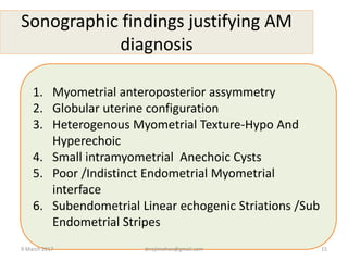 Sonographic findings justifying AM
diagnosis
1. Myometrial anteroposterior assymmetry
2. Globular uterine configuration
3. Heterogenous Myometrial Texture-Hypo And
Hyperechoic
4. Small intramyometrial Anechoic Cysts
5. Poor /Indistinct Endometrial Myometrial
interface
6. Subendometrial Linear echogenic Striations /Sub
Endometrial Stripes
9 March 2017 drrejimohan@gmail.com 15
 