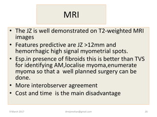 MRI
• The JZ is well demonstrated on T2-weighted MRI
images
• Features predictive are JZ >12mm and
hemorrhagic high signal myometrial spots.
• Esp.in presence of fibroids this is better than TVS
for identifying AM,localise myoma,enumerate
myoma so that a well planned surgery can be
done.
• More interobserver agreement
• Cost and time is the main disadvantage
9 March 2017 drrejimohan@gmail.com 20
 