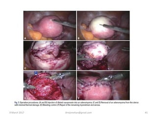 9 March 2017 drrejimohan@gmail.com 45
 