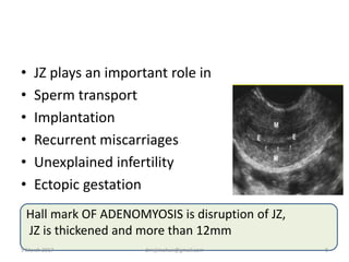 • JZ plays an important role in
• Sperm transport
• Implantation
• Recurrent miscarriages
• Unexplained infertility
• Ectopic gestation
Hall mark OF ADENOMYOSIS is disruption of JZ,
JZ is thickened and more than 12mm
9 March 2017 drrejimohan@gmail.com 8
 