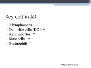 Key cell in AD
•   T lymphocytes
•   Dendritic cells (DCs)
•   Keratinocytes
•   Mast cells
•   Eosinophils




          ...