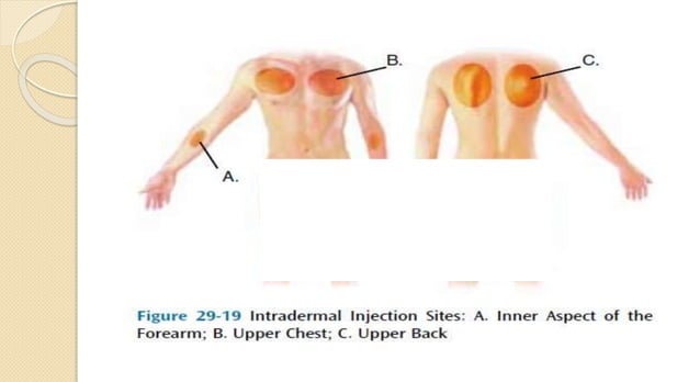 Checklist Intradermal Administering an intradermal injection.pptx