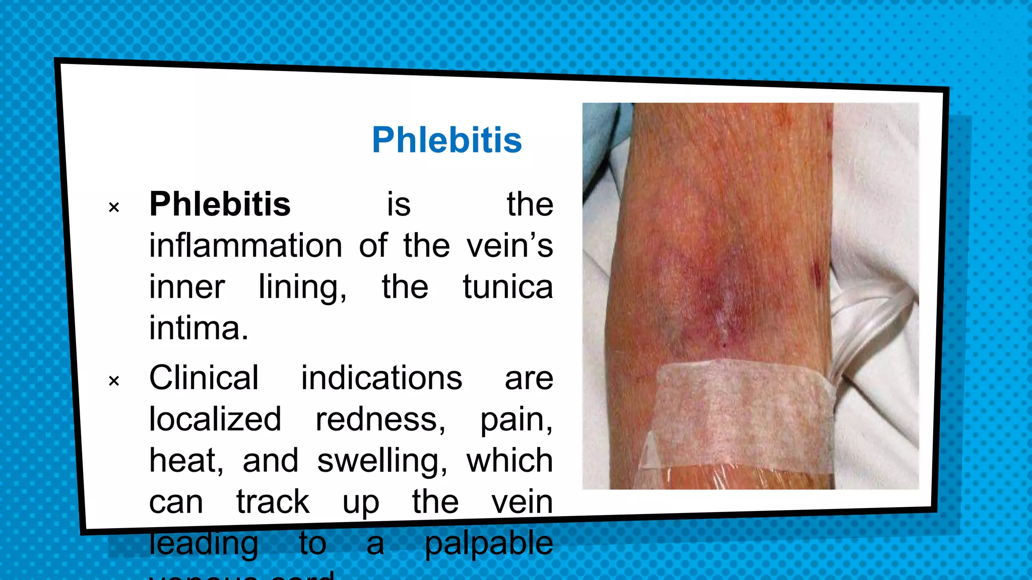 Administering medications by intravenous bolus or push | PPTX