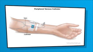 Administering medications by intravenous bolus or push | PPTX