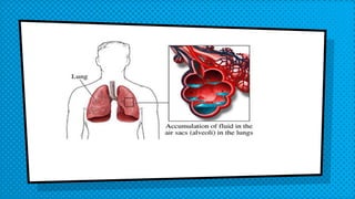 Administering medications by intravenous bolus or push | PPTX