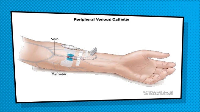 Administering medications by intravenous bolus or push