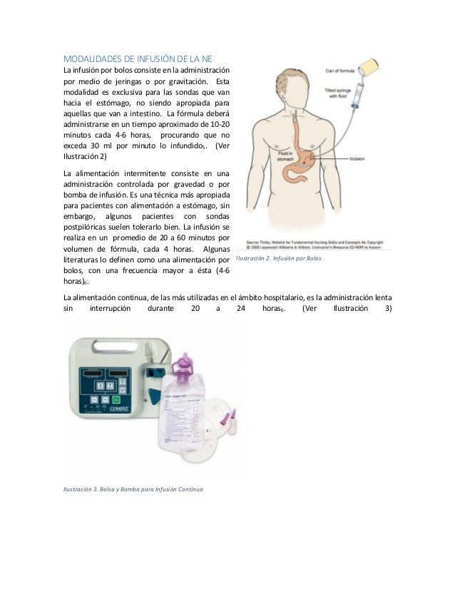Administración de la nutrición enteral