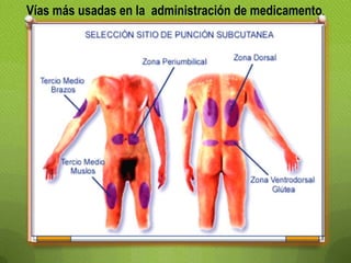 Vías más usadas en la administración de medicamento.
 