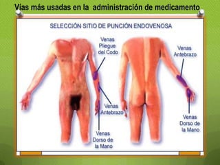 Vías más usadas en la administración de medicamento
 