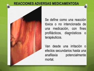 REACCIONES ADVERSAS MEDICAMENTOSA
.
Se define como una reacción
tóxica o no intencionada de
una medicación, con fines
profilácticos, diagnósticos o
terapéuticos.
Van desde una irritación o
efectos secundarios hasta una
anafilaxia potencialmente
mortal.
 