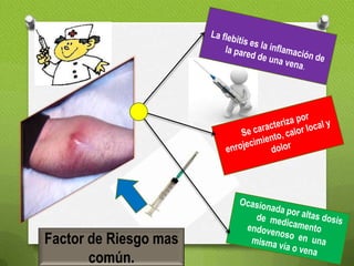 Factor de Riesgo mas
común.
 