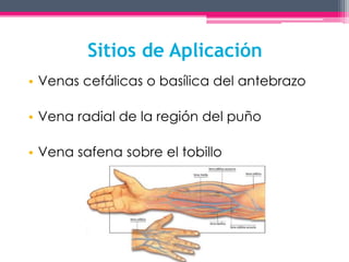 Sitios de Aplicación 
• Venas cefálicas o basílica del antebrazo 
• Vena radial de la región del puño 
• Vena safena sobre el tobillo 
 
