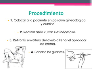 Procedimiento 
• 1. Colocar a la paciente en posición ginecológica 
y cubrirla. 
• 2. Realizar aseo vulvar si es necesario. 
• 3. Retirar la envoltura del ovulo o llenar el aplicador 
de crema. 
• 4. Ponerse los guantes. 
 