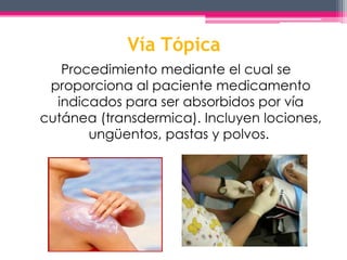 Vía Tópica 
Procedimiento mediante el cual se 
proporciona al paciente medicamento 
indicados para ser absorbidos por vía 
cutánea (transdermica). Incluyen lociones, 
ungüentos, pastas y polvos. 
 