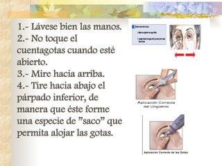 1.- Lávese bien las manos.
2.- No toque el
cuentagotas cuando esté
abierto.
3.- Mire hacia arriba.
4.- Tire hacia abajo el
párpado inferior, de
manera que éste forme
una especie de ”saco” que
permita alojar las gotas.
 