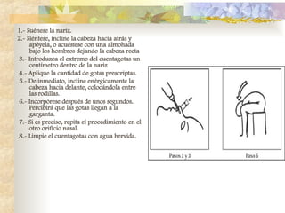 1.- Suénese la nariz.
2.- Siéntese, incline la cabeza hacia atrás y
apóyela, o acuéstese con una almohada
bajo los hombros dejando la cabeza recta
3.- Introduzca el extremo del cuentagotas un
centímetro dentro de la nariz
4.- Aplique la cantidad de gotas prescriptas.
5.- De inmediato, incline enérgicamente la
cabeza hacia delante, colocándola entre
las rodillas.
6.- Incorpórese después de unos segundos.
Percibirá que las gotas llegan a la
garganta.
7.- Si es preciso, repita el procedimiento en el
otro orificio nasal.
8.- Limpie el cuentagotas con agua hervida.
 