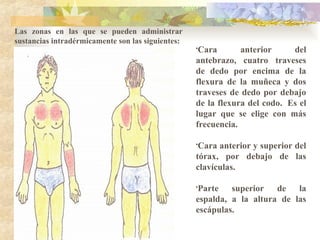 •Cara anterior del
antebrazo, cuatro traveses
de dedo por encima de la
flexura de la muñeca y dos
traveses de dedo por debajo
de la flexura del codo. Es el
lugar que se elige con más
frecuencia.
•Cara anterior y superior del
tórax, por debajo de las
clavículas.
•Parte superior de la
espalda, a la altura de las
escápulas.
Las zonas en las que se pueden administrar
sustancias intradérmicamente son las siguientes:
 